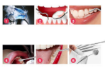 صورة Home Use Dental Tools Electric Teeth Cleaner With Led Screen